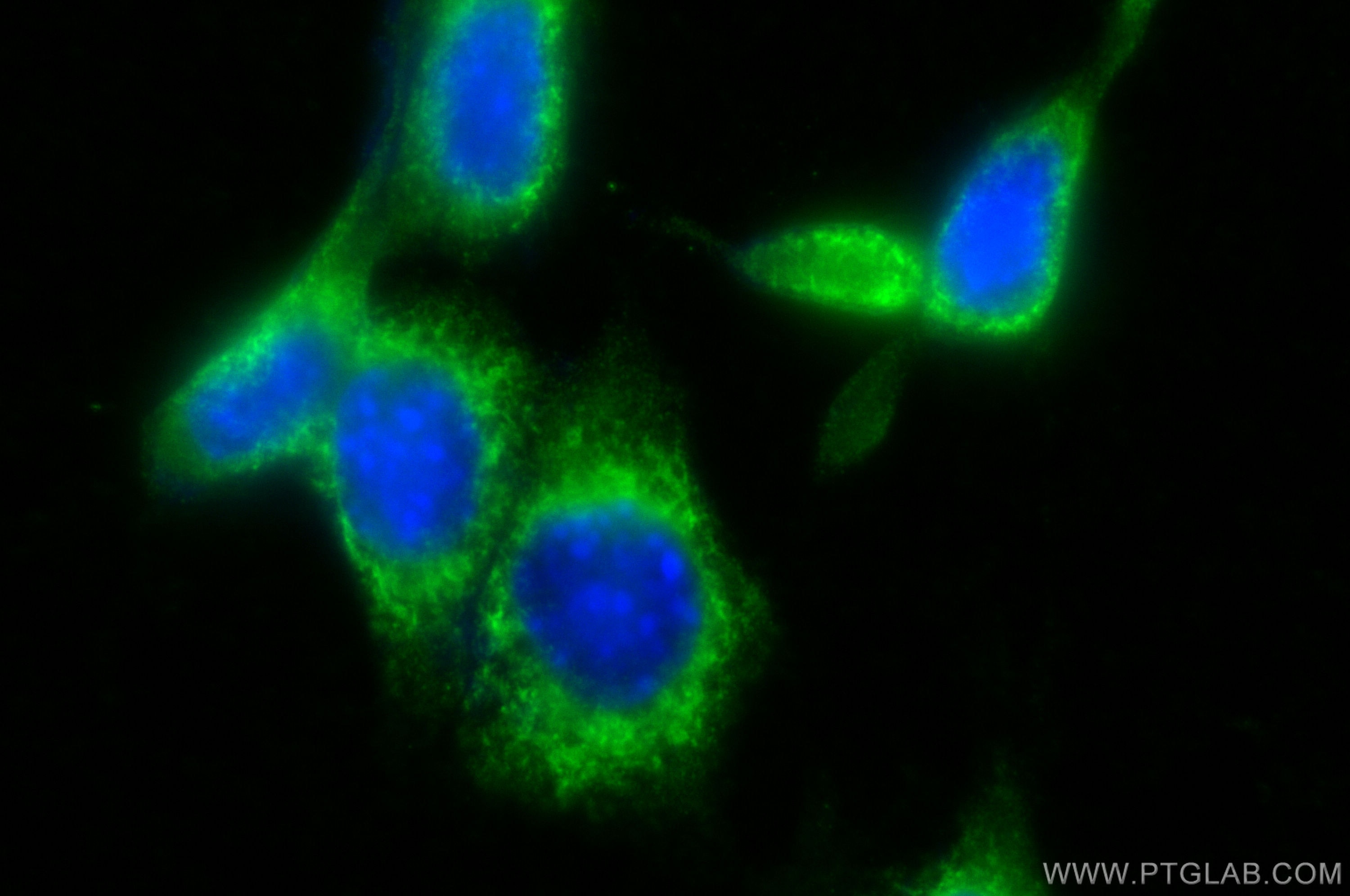 Immunofluorescence (IF) / fluorescent staining of NIH/3T3 cells using RRBP1 Polyclonal antibody (22015-1-AP)