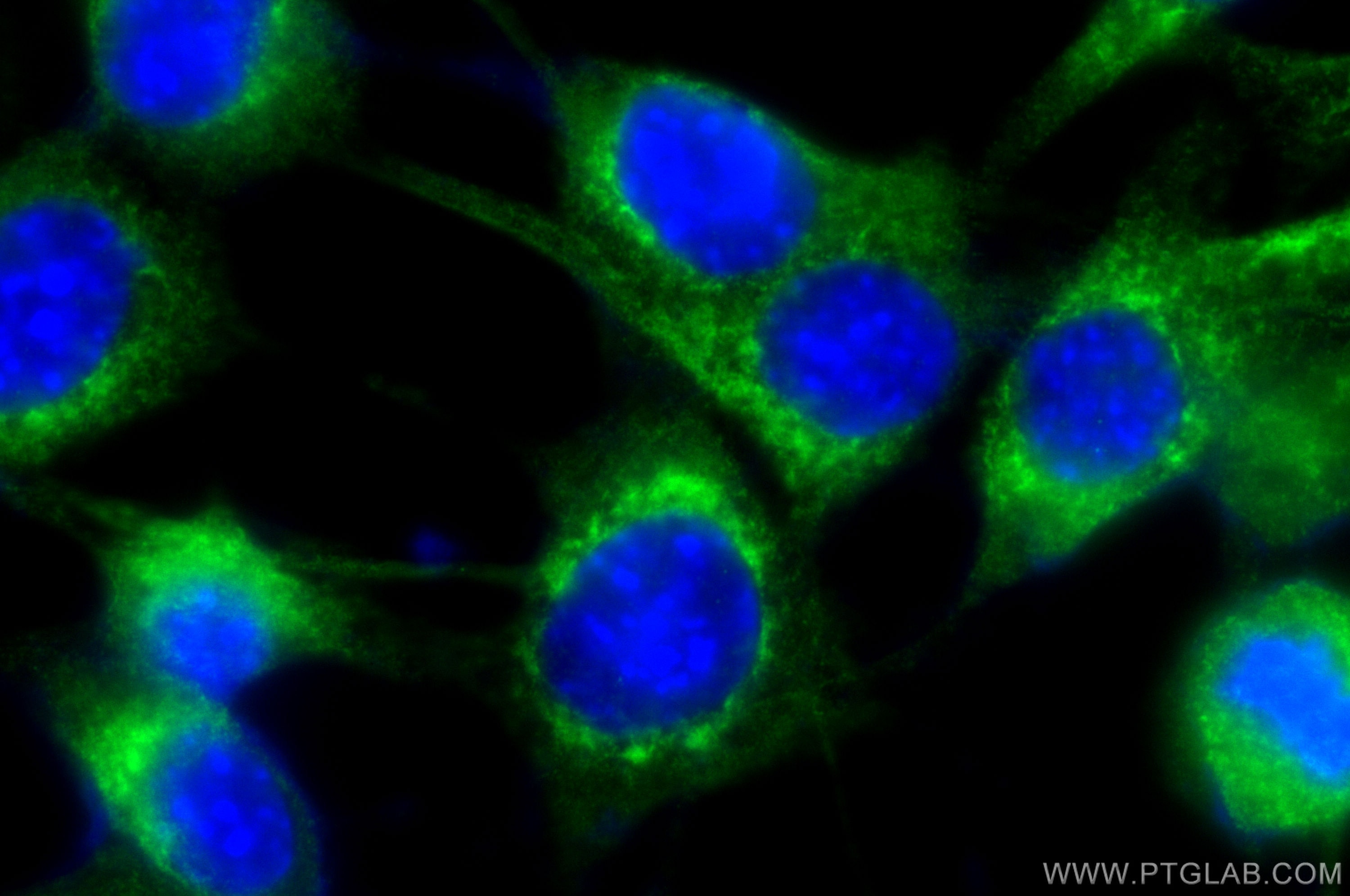 Immunofluorescence (IF) / fluorescent staining of NIH/3T3 cells using RRBP1 Polyclonal antibody (22015-1-AP)