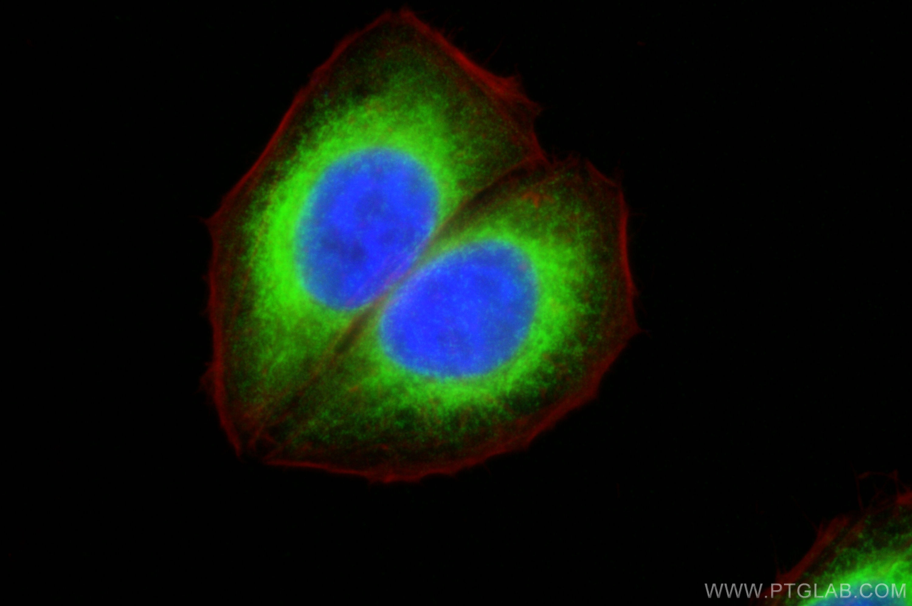 Immunofluorescence (IF) / fluorescent staining of HepG2 cells using RRBP1 Polyclonal antibody (22015-1-AP)