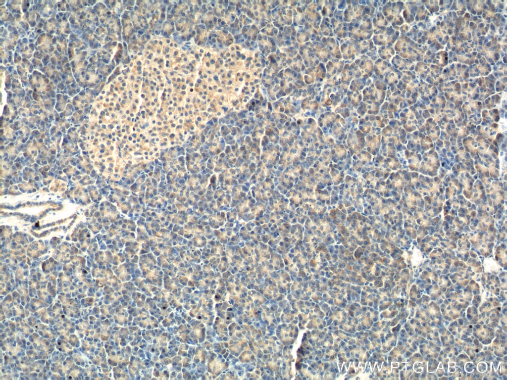 Immunohistochemistry (IHC) staining of human pancreas tissue using RRBP1 Polyclonal antibody (22015-1-AP)