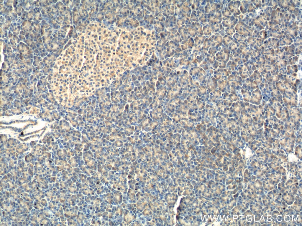 IHC staining of human pancreas using 22015-1-AP