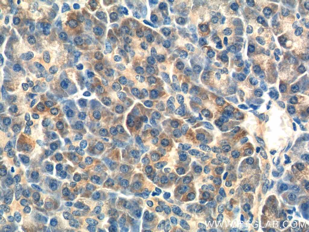 Immunohistochemistry (IHC) staining of human pancreas tissue using RRBP1 Polyclonal antibody (22015-1-AP)