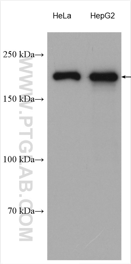Western Blot (WB) analysis of various lysates using RRBP1 Polyclonal antibody (22015-1-AP)