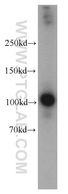 Western Blot (WB) analysis of mouse pancreas tissue using RRBP1 Polyclonal antibody (22015-1-AP)