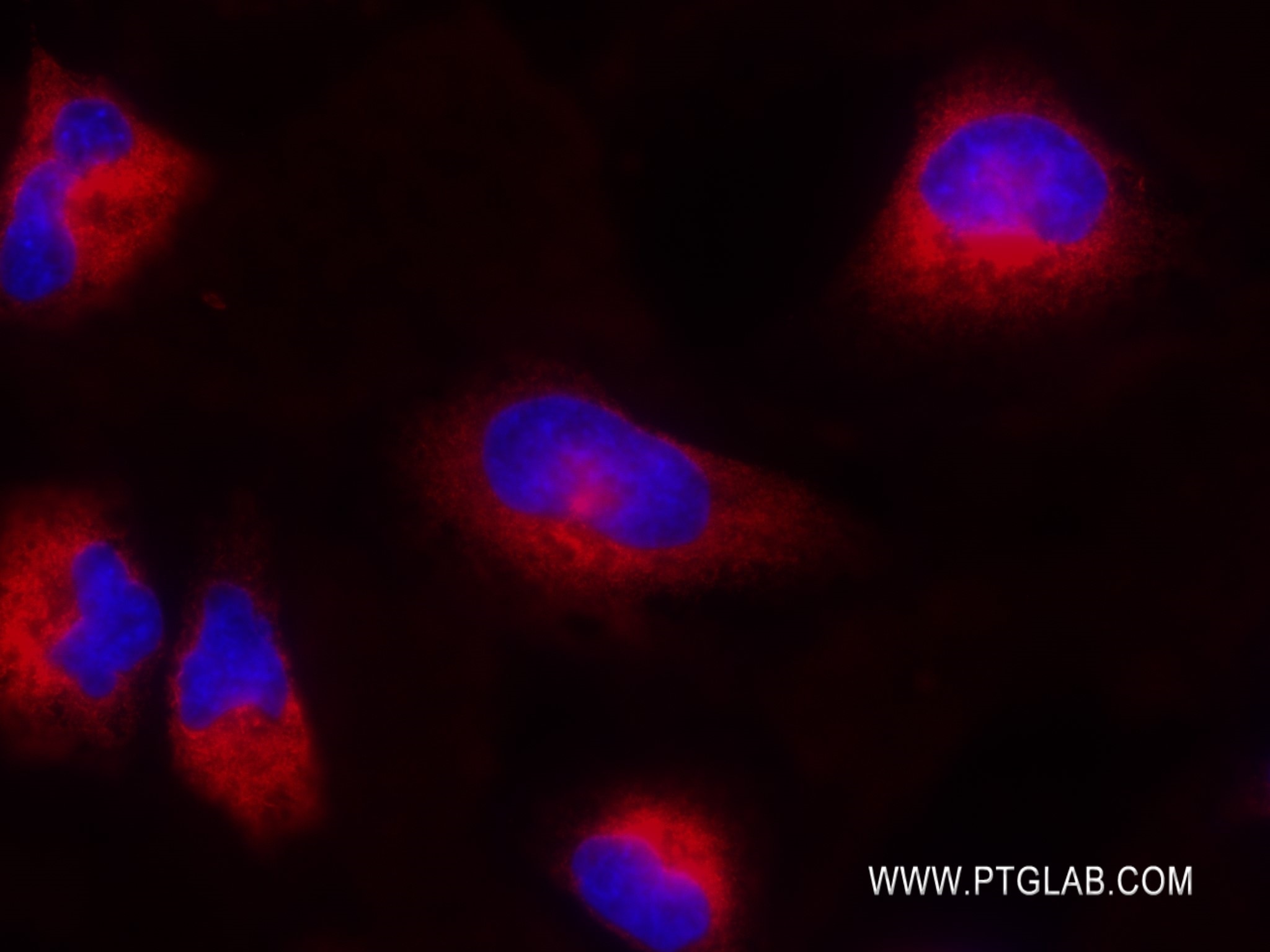 Immunofluorescence (IF) / fluorescent staining of HeLa cells using RRBP1 Recombinant antibody (82890-1-RR)