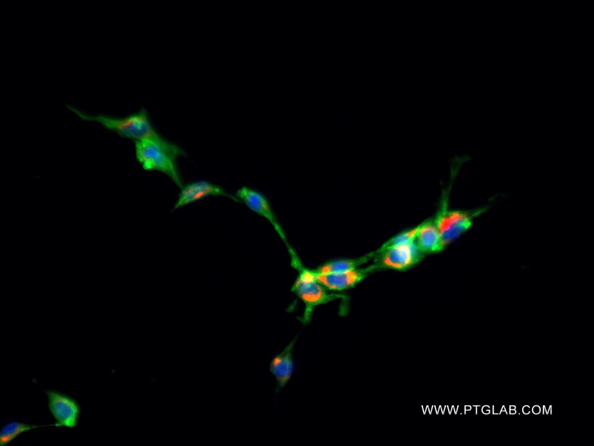 Immunofluorescence (IF) / fluorescent staining of NIH/3T3 cells using RRBP1 Recombinant antibody (82890-1-RR)