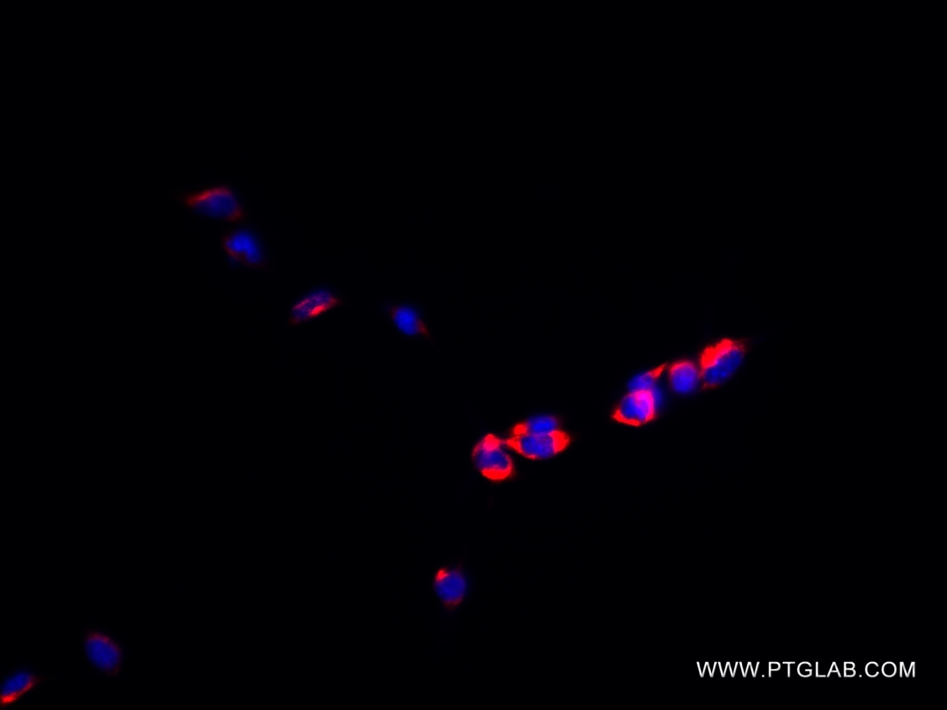 Immunofluorescence (IF) / fluorescent staining of NIH/3T3 cells using RRBP1 Recombinant antibody (82890-1-RR)