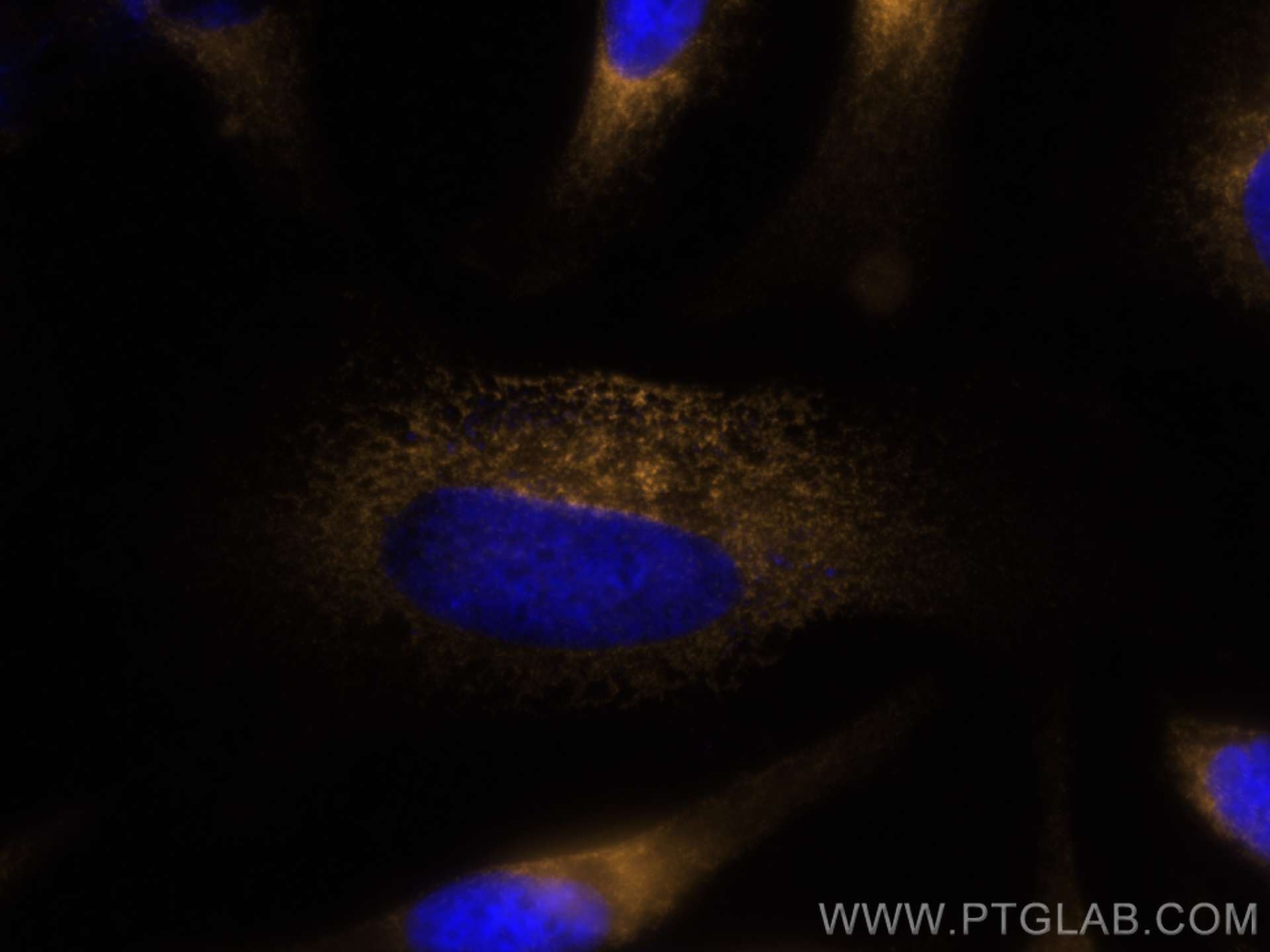 Immunofluorescence (IF) / fluorescent staining of HeLa cells using CoraLite®555-conjugated RRBP1 Polyclonal antibody (CL555-22015)