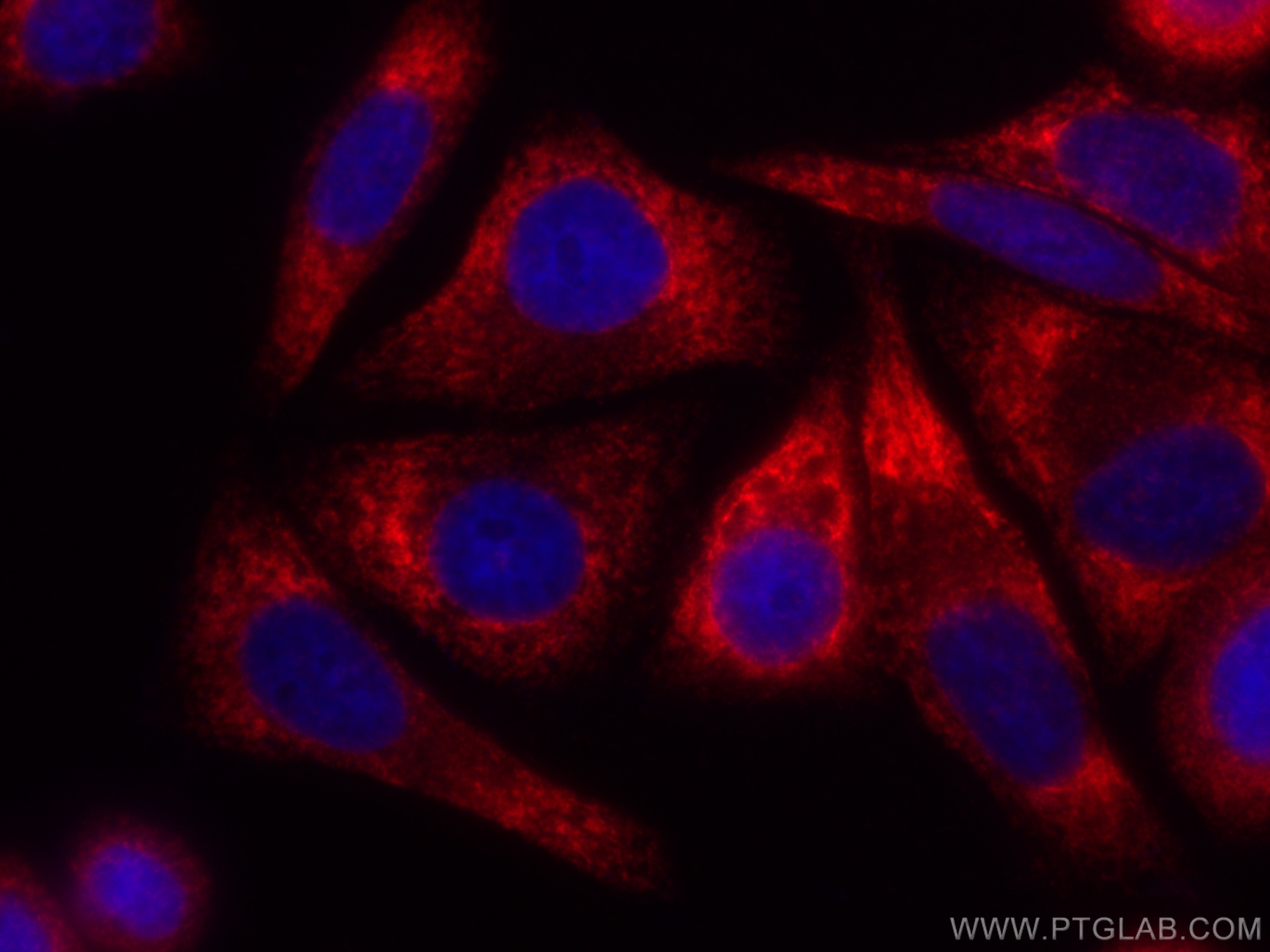 IF Staining of HepG2 using CL594-22015