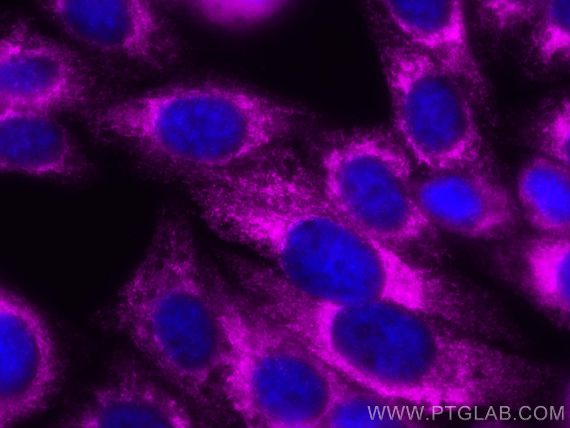 Immunofluorescence (IF) / fluorescent staining of HepG2 cells using CoraLite® Plus 647-conjugated RRBP1 Polyclonal ant (CL647-22015)