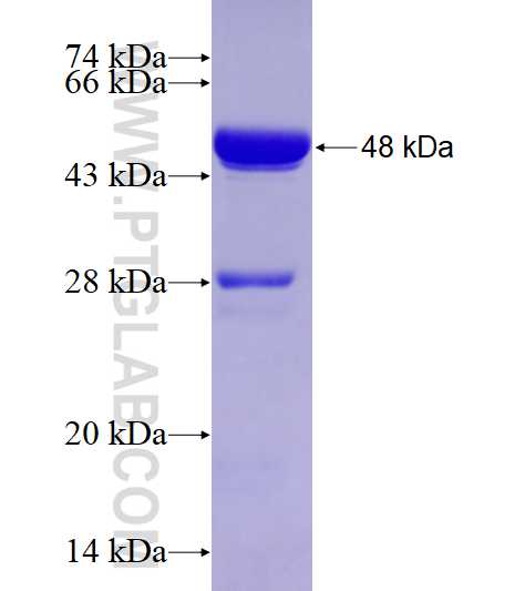 RRBP1 fusion protein Ag17431 SDS-PAGE