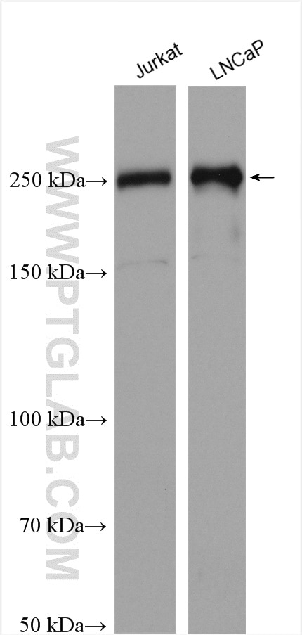 Western Blot (WB) analysis of various lysates using RREB1 Polyclonal antibody (27706-1-AP)