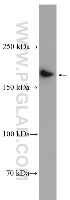 Western Blot (WB) analysis of BxPC-3 cells using RREB1-Specific Polyclonal antibody (20280-1-AP)