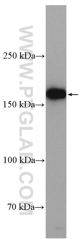 Western Blot (WB) analysis of SH-SY5Y cells using RREB1-Specific Polyclonal antibody (20280-1-AP)