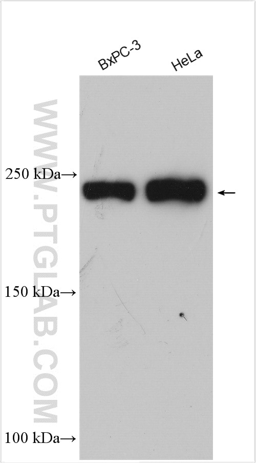 Western Blot (WB) analysis of various lysates using RREB1-Specific Polyclonal antibody (20280-1-AP)