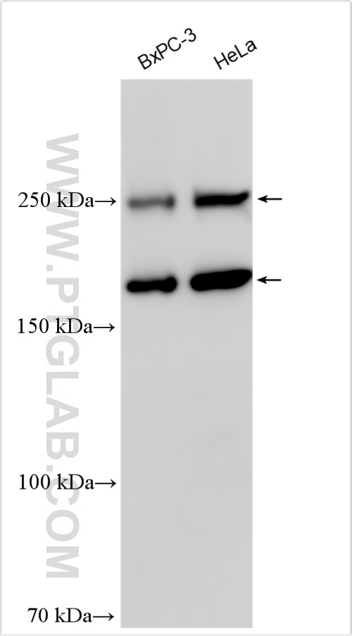 Western Blot (WB) analysis of various lysates using RREB1-Specific Polyclonal antibody (20280-1-AP)