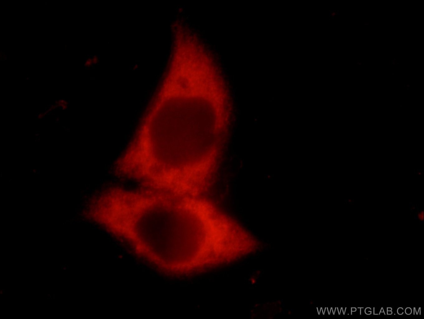 Immunofluorescence (IF) / fluorescent staining of MCF-7 cells using RRM1 Polyclonal antibody (10526-1-AP)