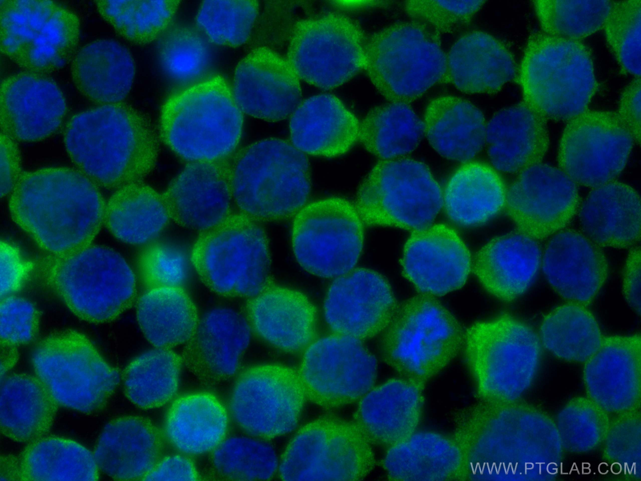 Immunofluorescence (IF) / fluorescent staining of Raji cells using RRM1 Polyclonal antibody (10526-1-AP)
