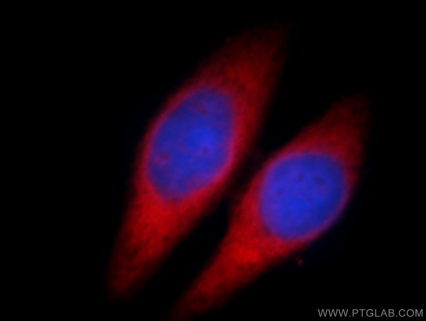 Immunofluorescence (IF) / fluorescent staining of HepG2 cells using RRM1 Polyclonal antibody (10526-1-AP)