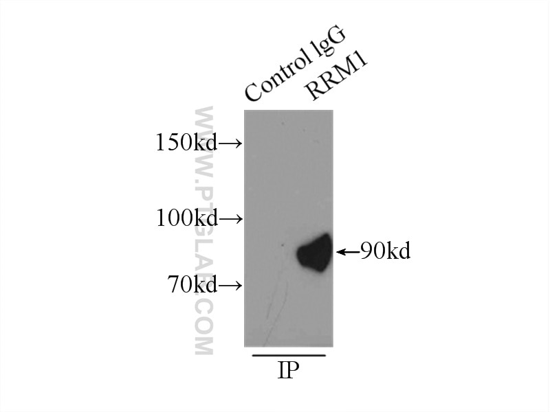 Immunoprecipitation (IP) experiment of K-562 cells using RRM1 Polyclonal antibody (10526-1-AP)