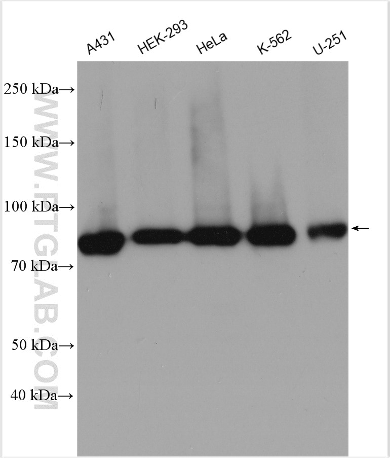 Western Blot (WB) analysis of various lysates using RRM1 Polyclonal antibody (10526-1-AP)