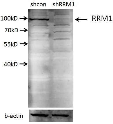 Western Blot (WB) analysis of A549 cells using RRM1 Polyclonal antibody (10526-1-AP)