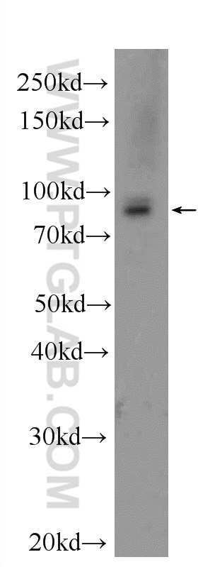 Western Blot (WB) analysis of rat skeletal muscle tissue using RRM1 Polyclonal antibody (10526-1-AP)