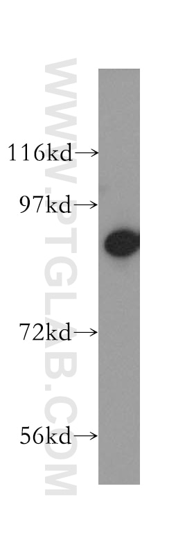 Western Blot (WB) analysis of K-562 cells using RRM1 Polyclonal antibody (10526-1-AP)