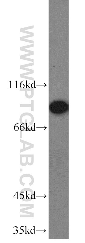 Western Blot (WB) analysis of HeLa cells using RRM1 Polyclonal antibody (10526-1-AP)