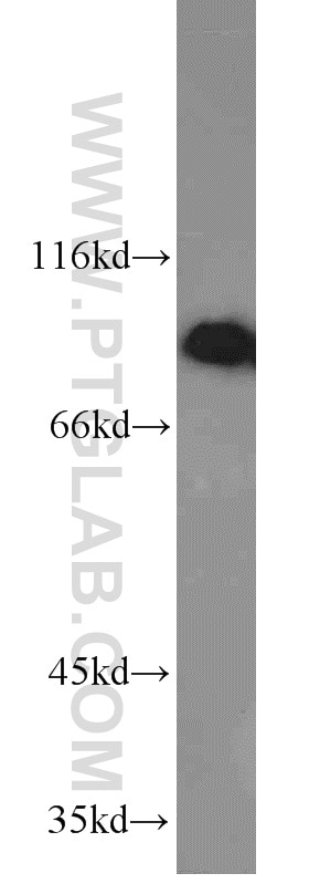 Western Blot (WB) analysis of A549 cells using RRM1 Polyclonal antibody (10526-1-AP)