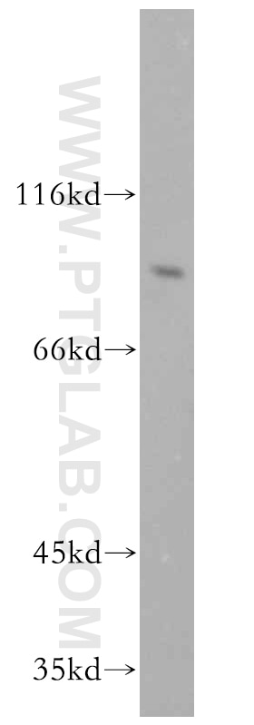 Western Blot (WB) analysis of BxPC-3 cells using RRM1 Polyclonal antibody (10526-1-AP)
