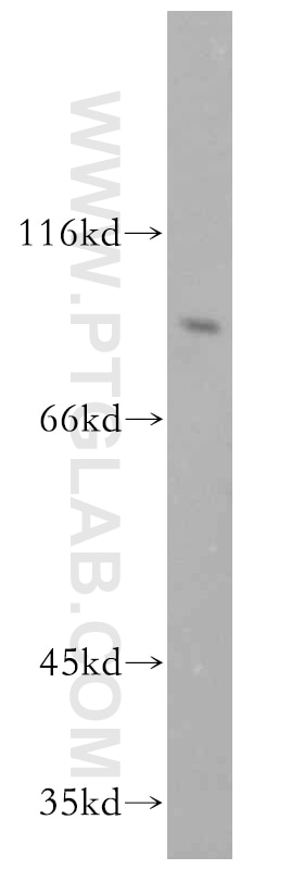 WB analysis of BxPC-3 using 10526-1-AP