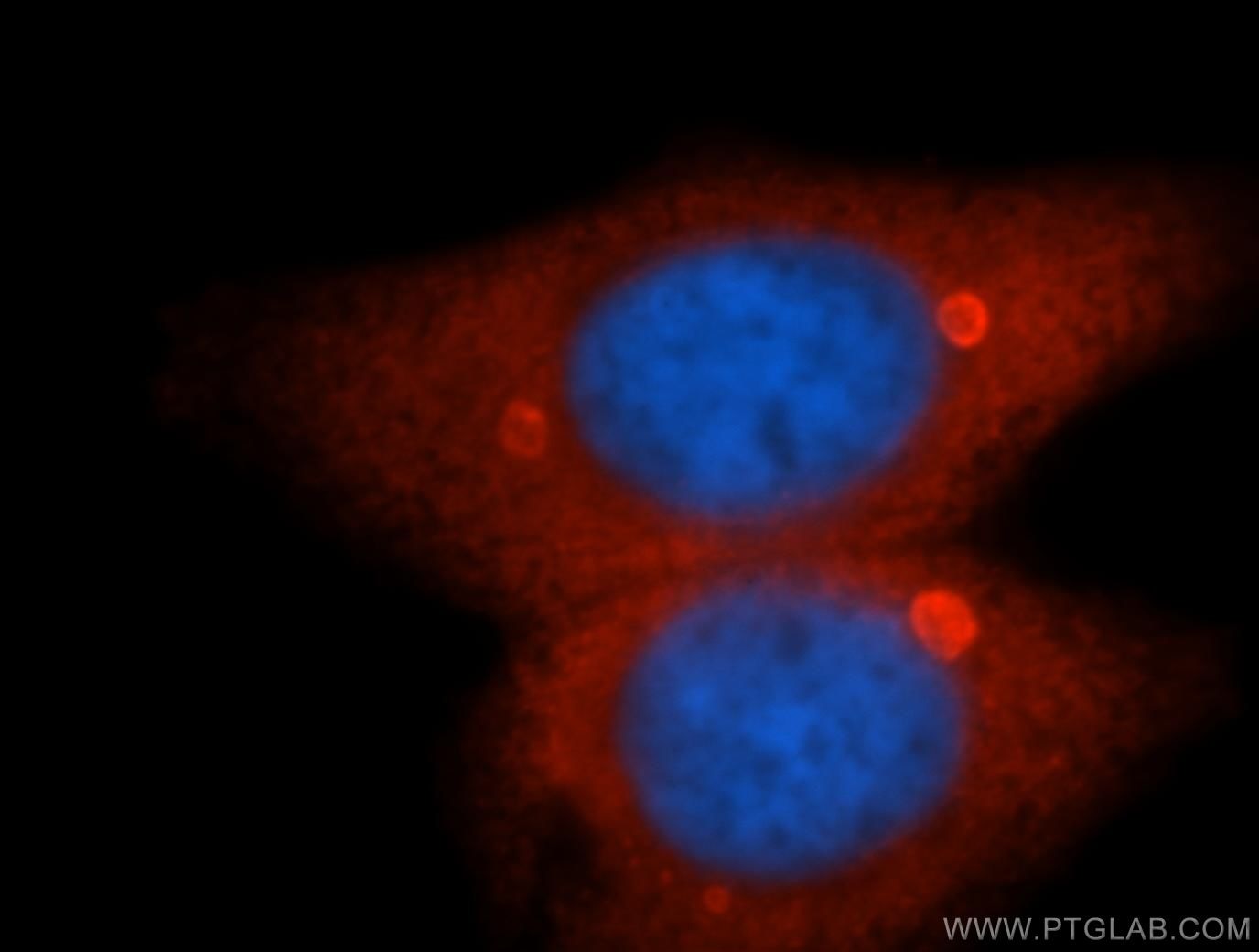 Immunofluorescence (IF) / fluorescent staining of HepG2 cells using RRM1 Monoclonal antibody (60073-1-Ig)