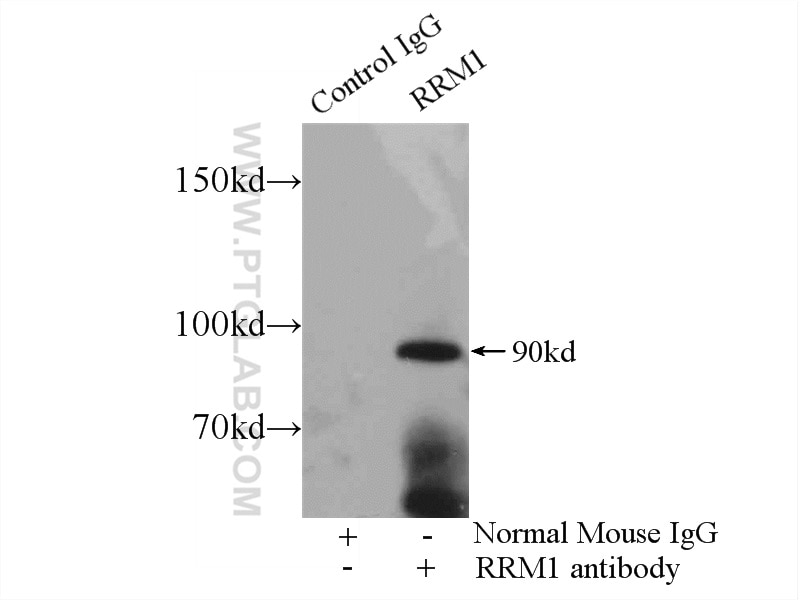 Immunoprecipitation (IP) experiment of K-562 cells using RRM1 Monoclonal antibody (60073-1-Ig)