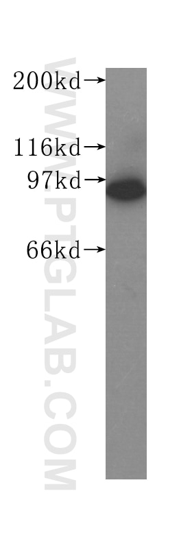 Western Blot (WB) analysis of K-562 cells using RRM1 Monoclonal antibody (60073-1-Ig)