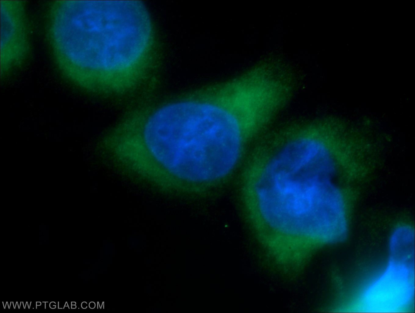 Immunofluorescence (IF) / fluorescent staining of HeLa cells using RRM1 Monoclonal antibody (60073-2-Ig)