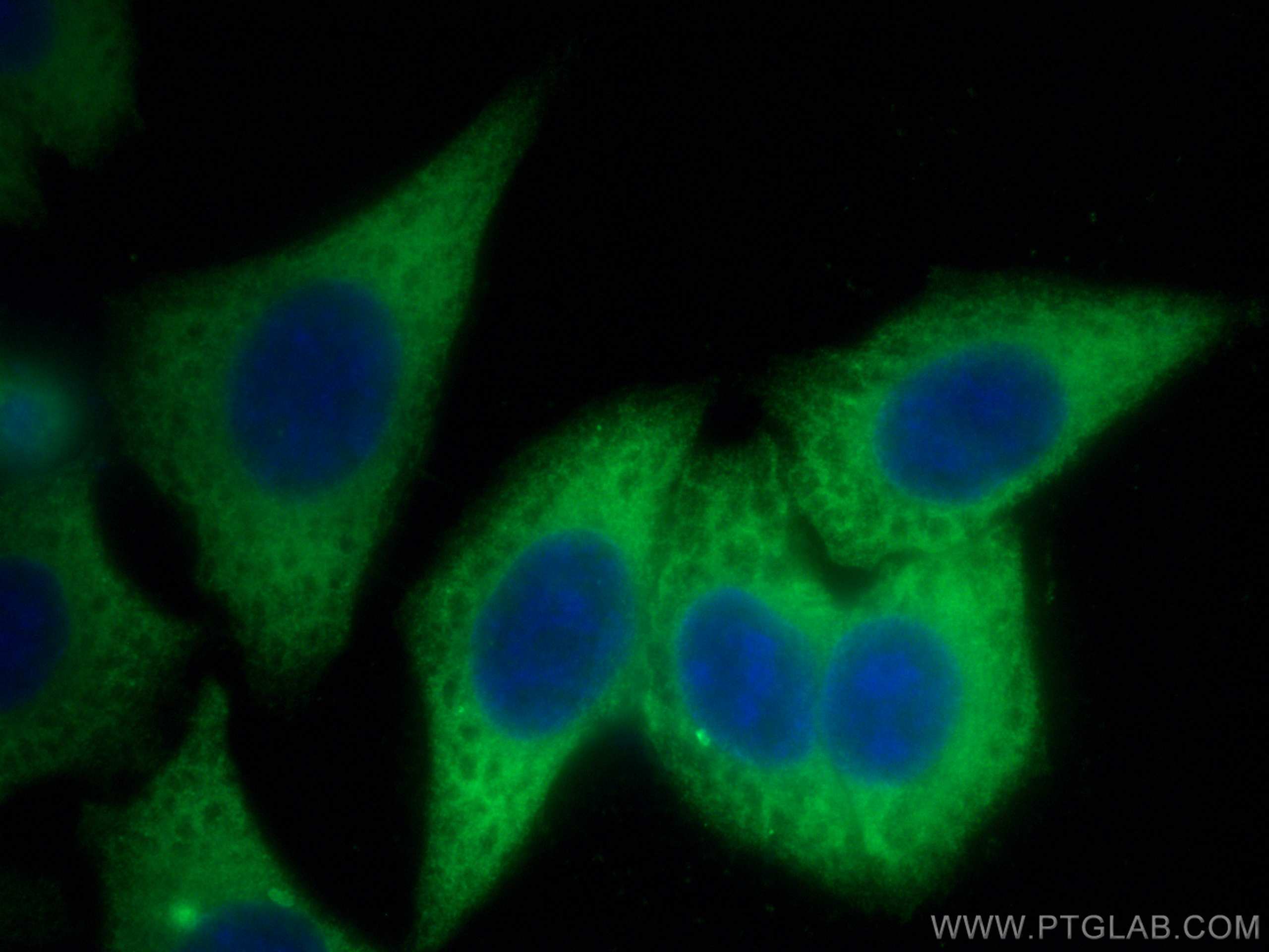 Immunofluorescence (IF) / fluorescent staining of HepG2 cells using RRM1 Monoclonal antibody (60073-2-Ig)