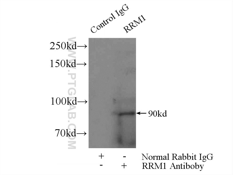 Immunoprecipitation (IP) experiment of K-562 cells using RRM1 Monoclonal antibody (60073-2-Ig)