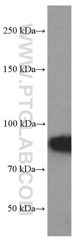 Western Blot (WB) analysis of HeLa cells using RRM1 Monoclonal antibody (60073-2-Ig)