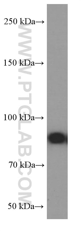 Western Blot (WB) analysis of K-562 cells using RRM1 Monoclonal antibody (60073-2-Ig)