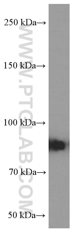Western Blot (WB) analysis of K-562 cells using RRM1 Monoclonal antibody (60073-2-Ig)