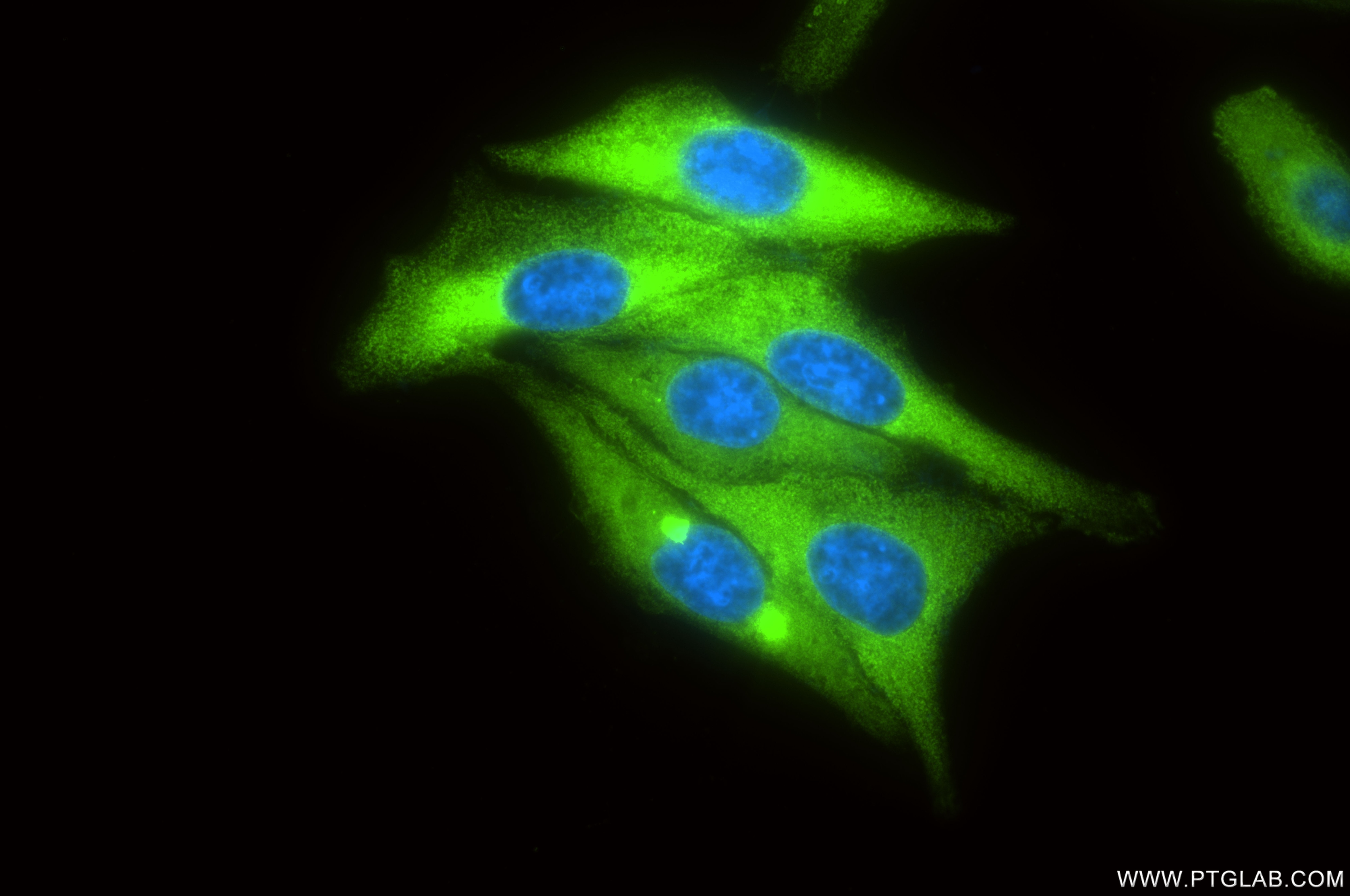 Immunofluorescence (IF) / fluorescent staining of HeLa cells using RRM1 Recombinant antibody (86135-1-RR)