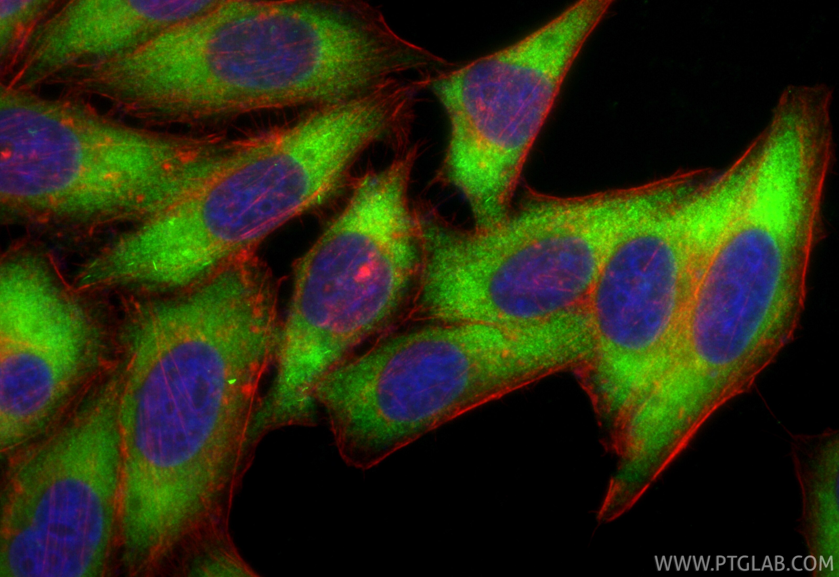 Immunofluorescence (IF) / fluorescent staining of HepG2 cells using CoraLite® Plus 488-conjugated RRM1 Recombinant ant (CL488-86135)