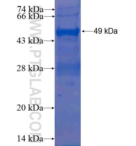 RRM1 fusion protein Ag0789 SDS-PAGE
