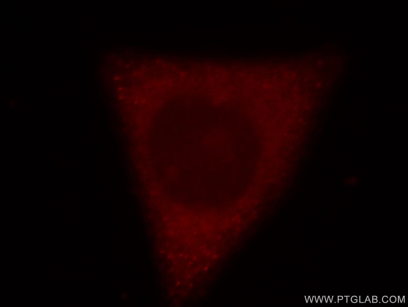 Immunofluorescence (IF) / fluorescent staining of HepG2 cells using RRM1-Specific Polyclonal antibody (19686-1-AP)