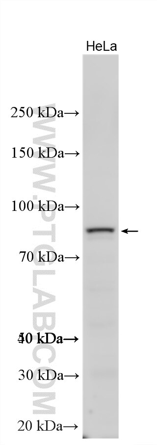 Various lysates were subjected to SDS PAGE followed by western blot with 19686-1-AP (RRM1 antibody) at dilution of 1:600 incubated at room temperature for 1.5 hours. Western Blot (WB) analysis of various lysates using RRM1 Polyclonal antibody (19686-1-AP)