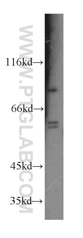 Western Blot (WB) analysis of HeLa cells using RRM1-Specific Polyclonal antibody (19686-1-AP)