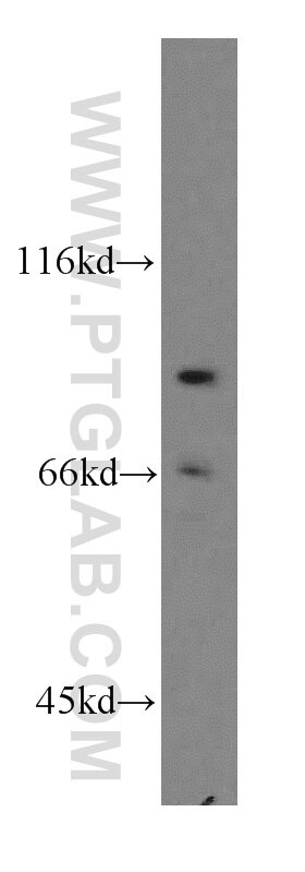 Western Blot (WB) analysis of HEK-293 cells using RRM1-Specific Polyclonal antibody (19686-1-AP)