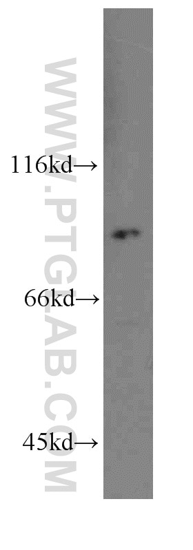 Western Blot (WB) analysis of A549 cells using RRM1-Specific Polyclonal antibody (19686-1-AP)