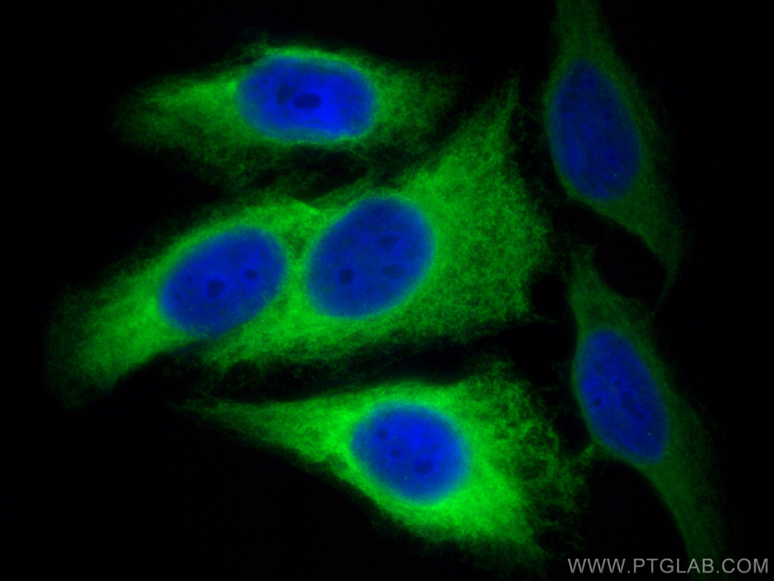 Immunofluorescence (IF) / fluorescent staining of HepG2 cells using RRM2 Polyclonal antibody (11661-1-AP)